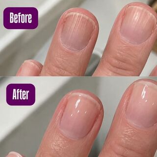 Smoothing Ridge Filler - Nail Treatment